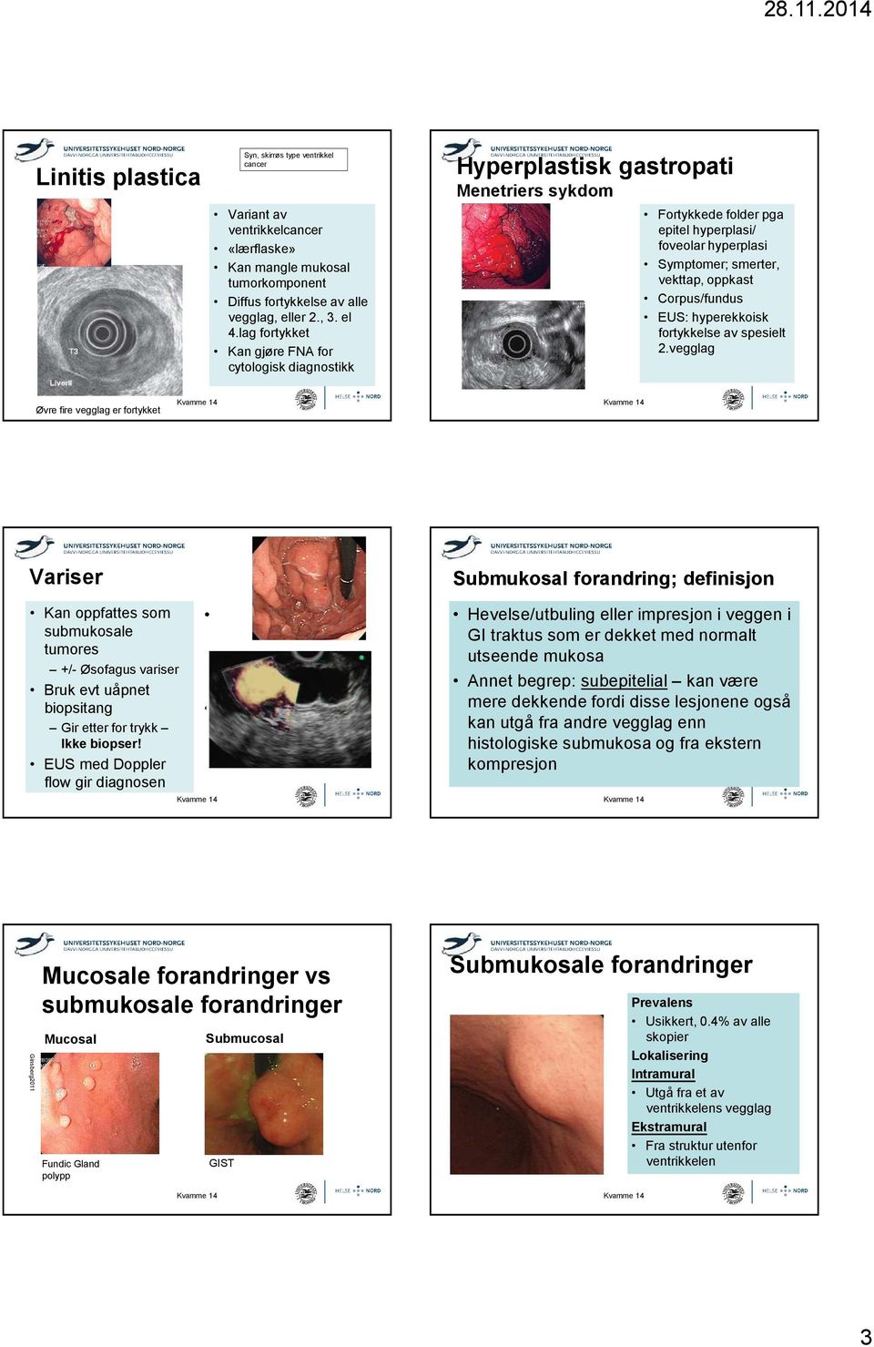 Corpus/fundus EUS: hyperekkoisk fortykkelse av spesielt 2.