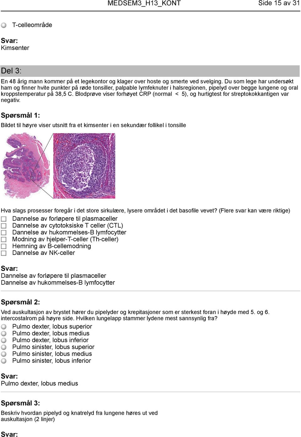 Blodprøve viser forhøyet CRP (normal < 5), og hurtigtest for streptokokkantigen var negativ.