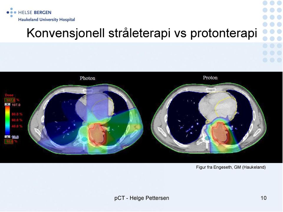 protonterapi Figur fra