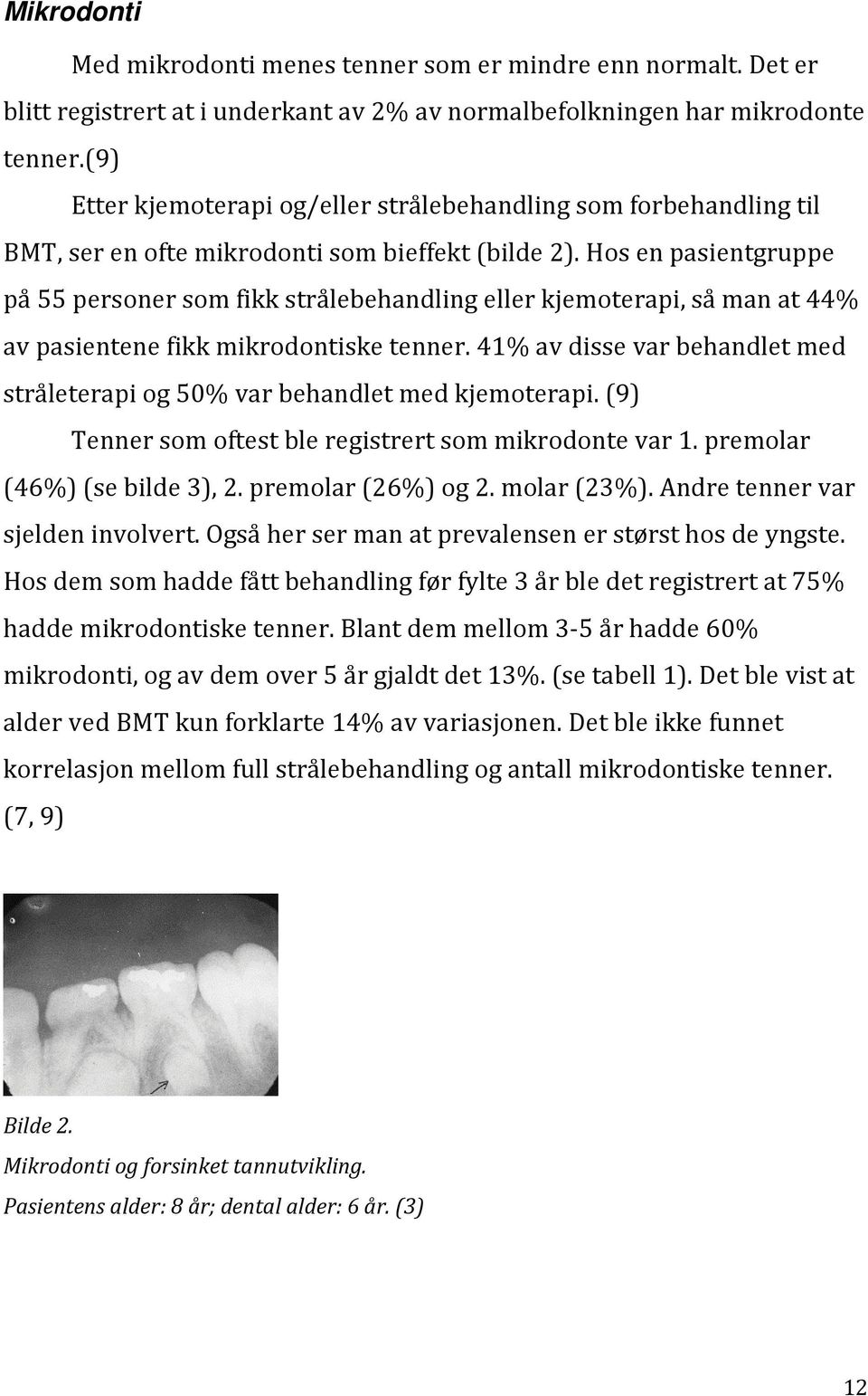 Hos en pasientgruppe på 55 personer som fikk strålebehandling eller kjemoterapi, så man at 44% av pasientene fikk mikrodontiske tenner.