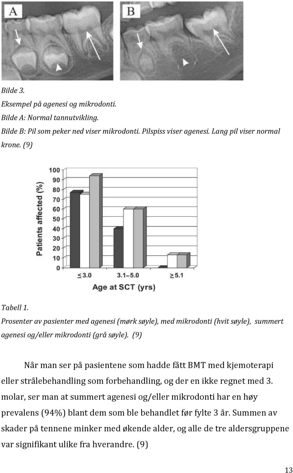 (9) Når man ser på pasientene som hadde fått BMT med kjemoterapi eller strålebehandling som forbehandling, og der en ikke regnet med 3.