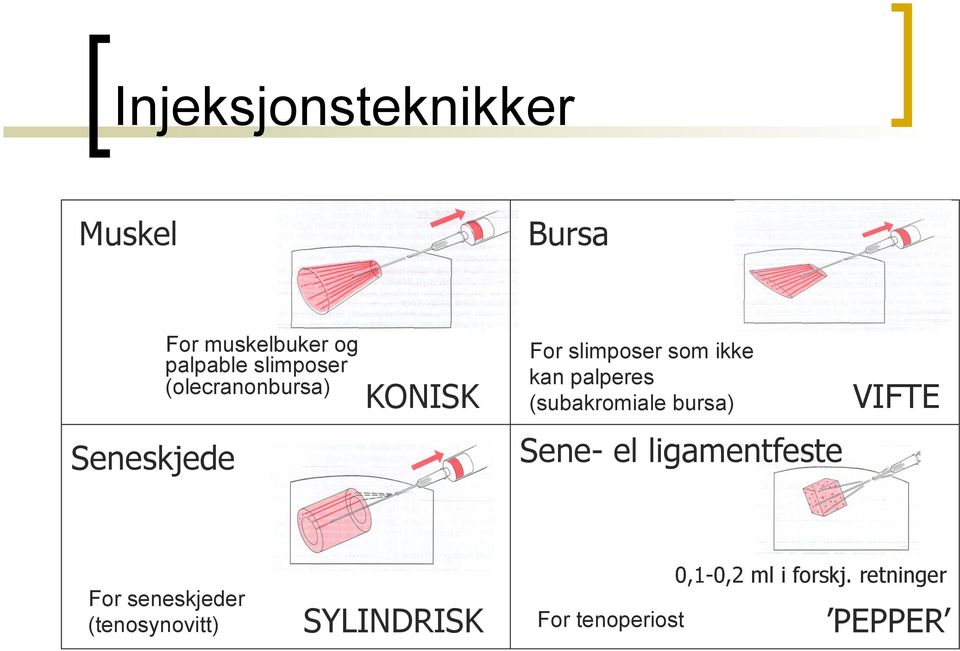 (subakromiale bursa) VIFTE Seneskjede Sene- el ligamentfeste For