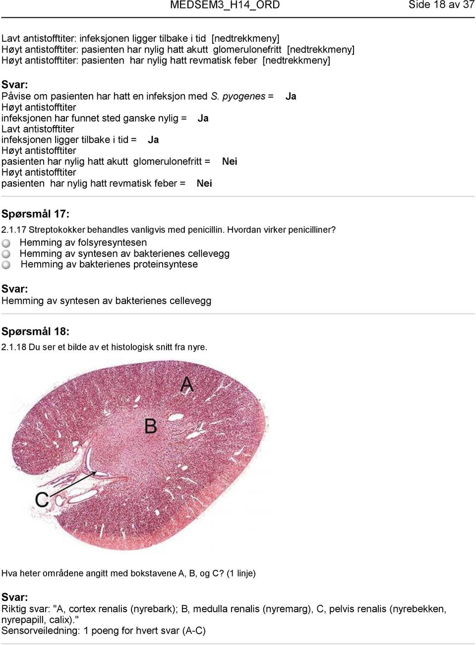 pyogenes = Høyt antistofftiter infeksjonen har funnet sted ganske nylig = Lavt antistofftiter infeksjonen ligger tilbake i tid = Høyt antistofftiter pasienten har nylig hatt akutt glomerulonefritt =