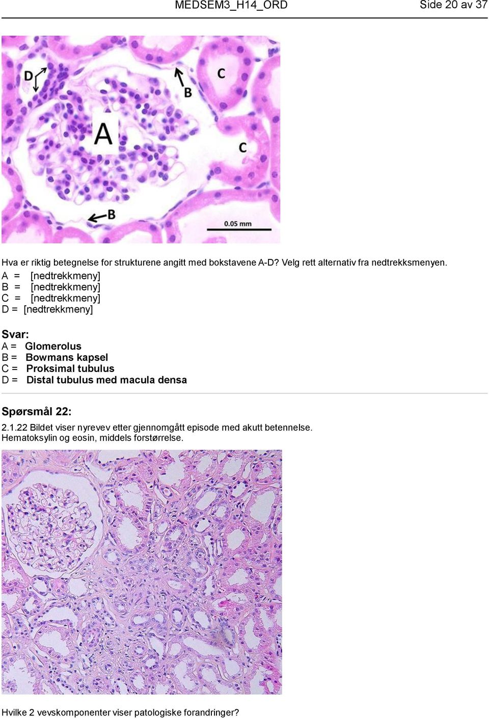 A = B = C = D = A = Glomerolus B = Bowmans kapsel C = Proksimal tubulus D = Distal tubulus med macula densa