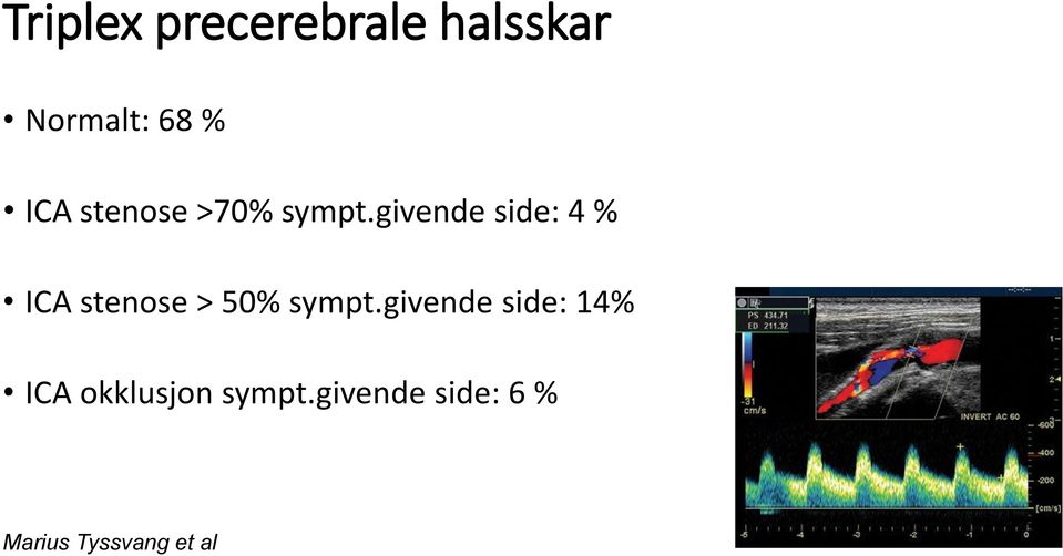 givende side: 4 % ICA stenose > 50% sympt.