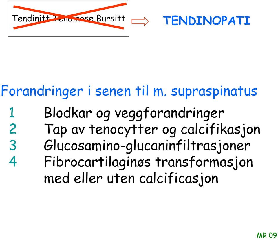 supraspinatus 1 Blodkar og veggforandringer 2 Tap av tenocytter