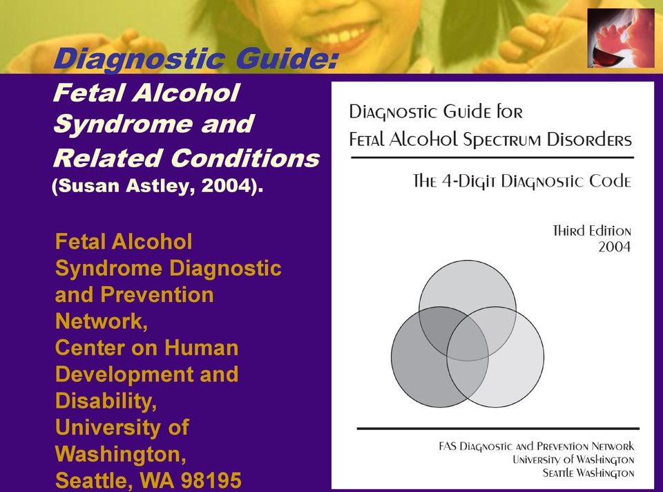 Fetal Alcohol Syndrome Diagnostic and Prevention Network,