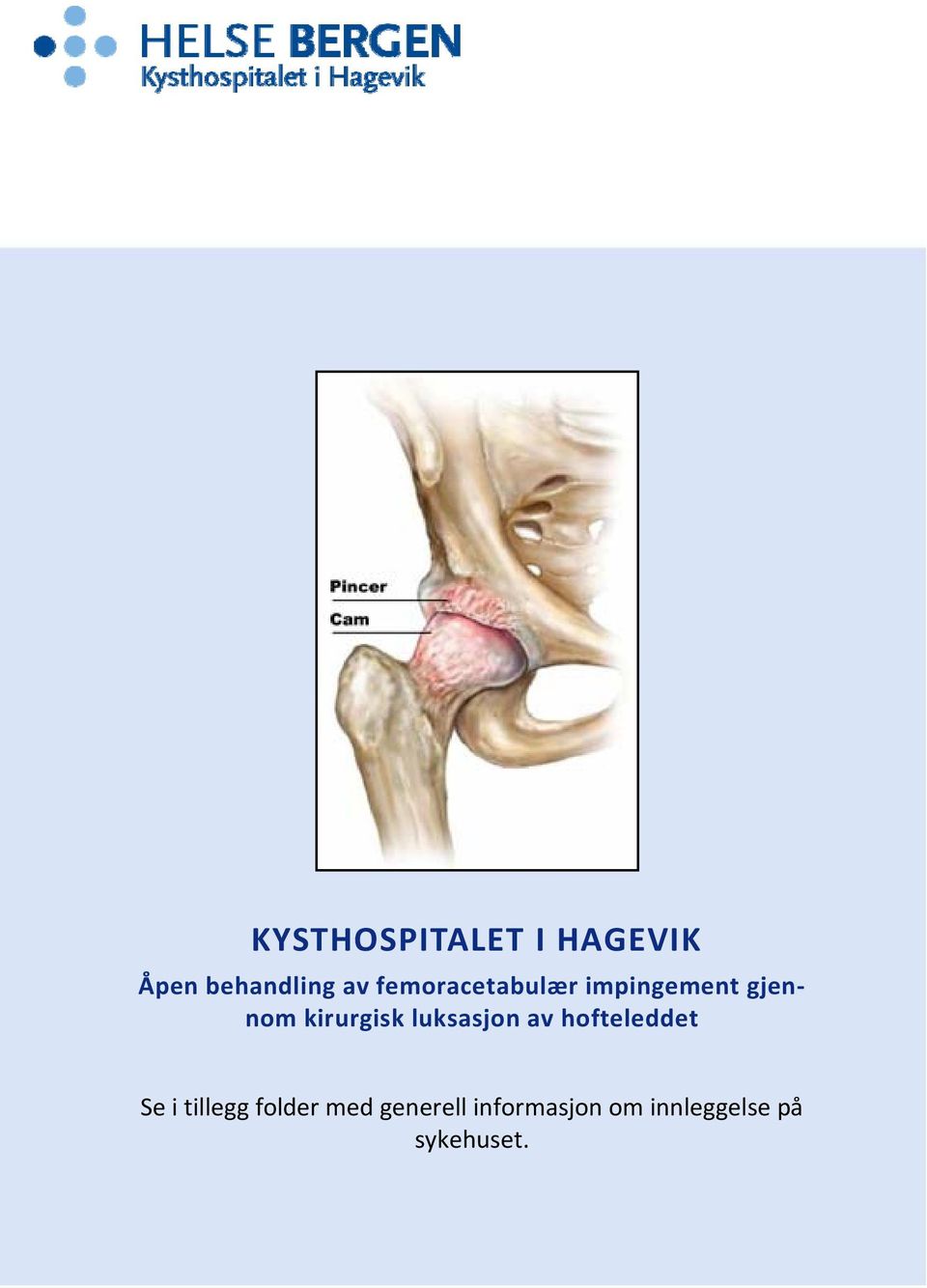 luksasjon av hofteleddet Se i tillegg folder med