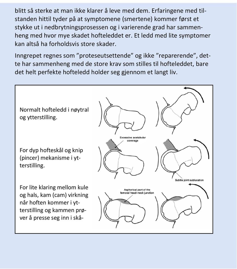 Et ledd med lite symptomer kan altså ha forholdsvis store skader.