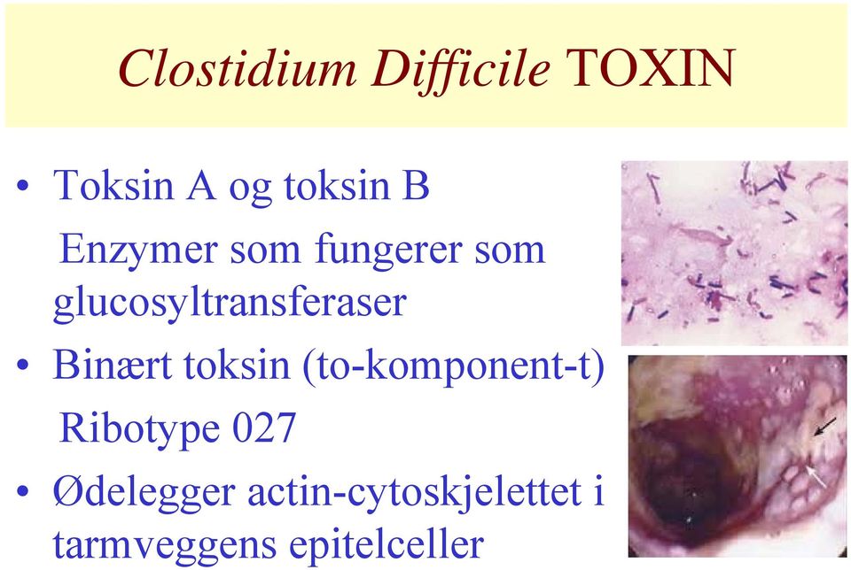 Binært toksin (to-komponent-t) Ribotype 027