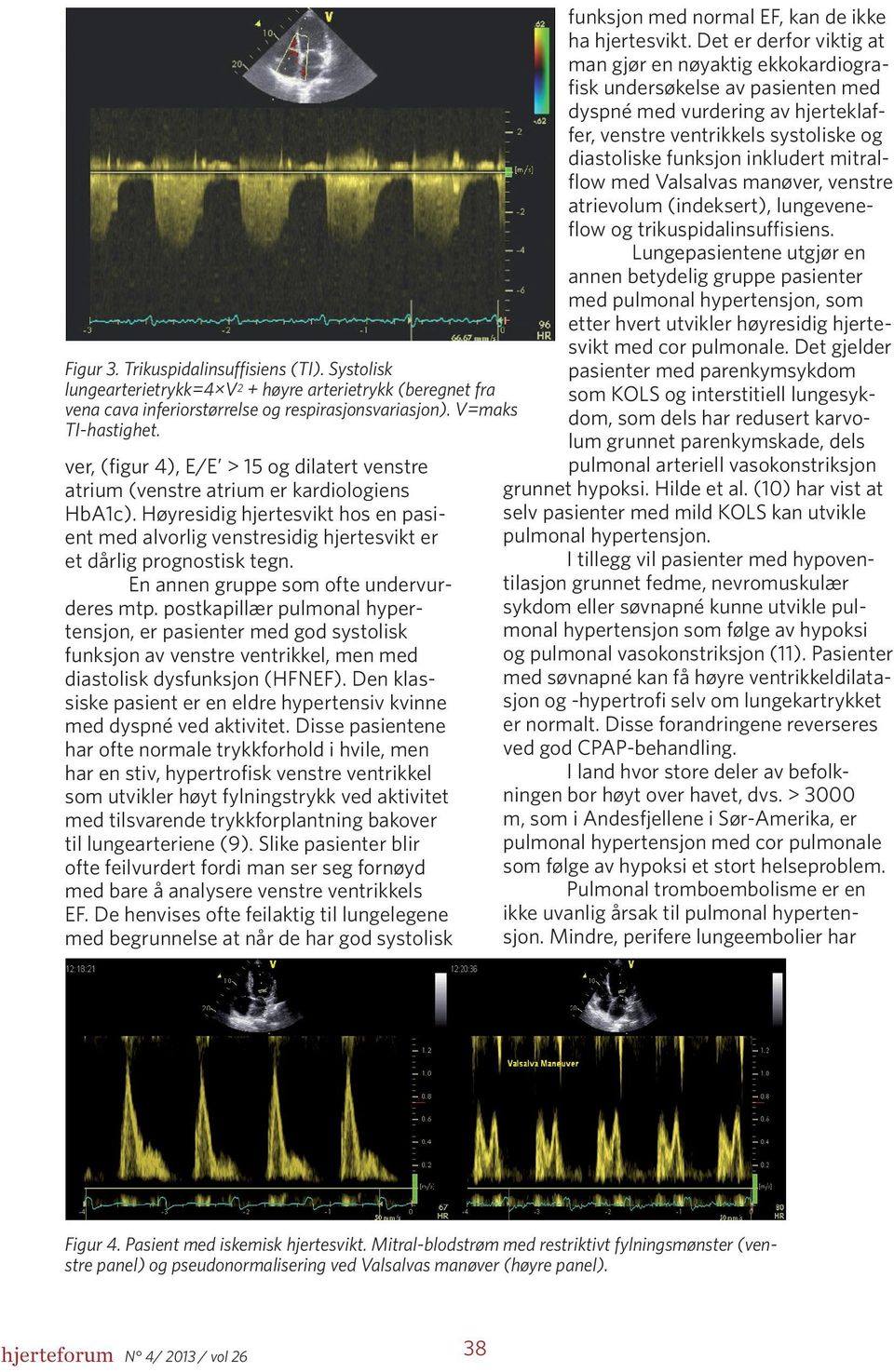 En annen gruppe som ofte undervurderes mtp. postkapillær pulmonal hypertensjon, er pasienter med god systolisk funksjon av venstre ventrikkel, men med diastolisk dysfunksjon (HFNEF).