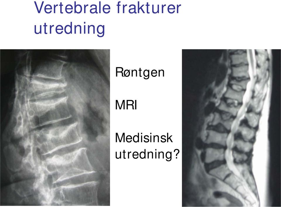 utredning