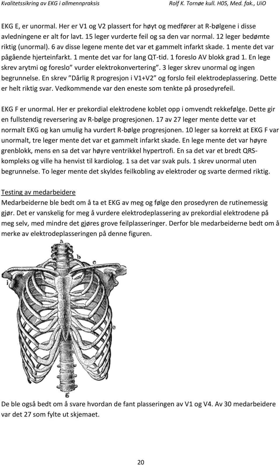 En lege skrev arytmi og foreslo vurder elektrokonvertering. 3 leger skrev unormal og ingen begrunnelse. En skrev Dårlig R progresjon i V1+V2 og forslo feil elektrodeplassering.