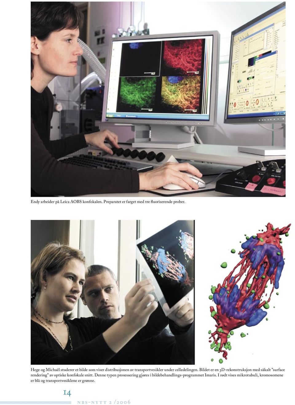 Bildet er en 3D-rekonstruksjon med såkalt surface rendering av optiske konfokale snitt.