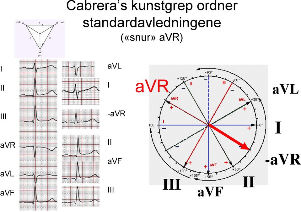 avr) I avl II I avr avl III avr