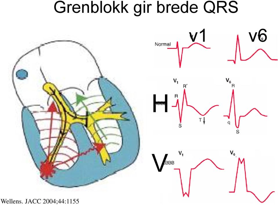 v6 H V Wellens.