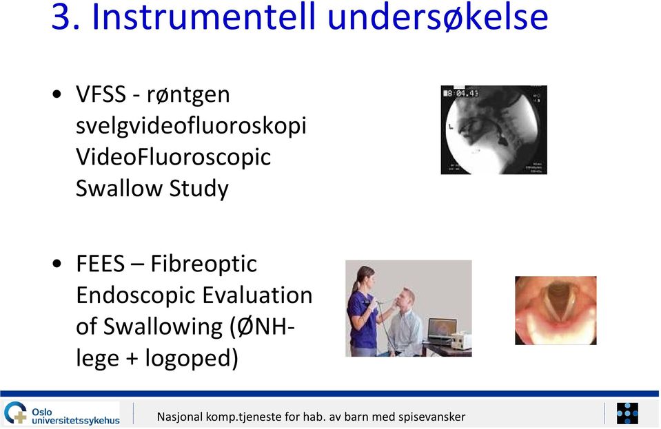 VideoFluoroscopic Swallow Study FEES