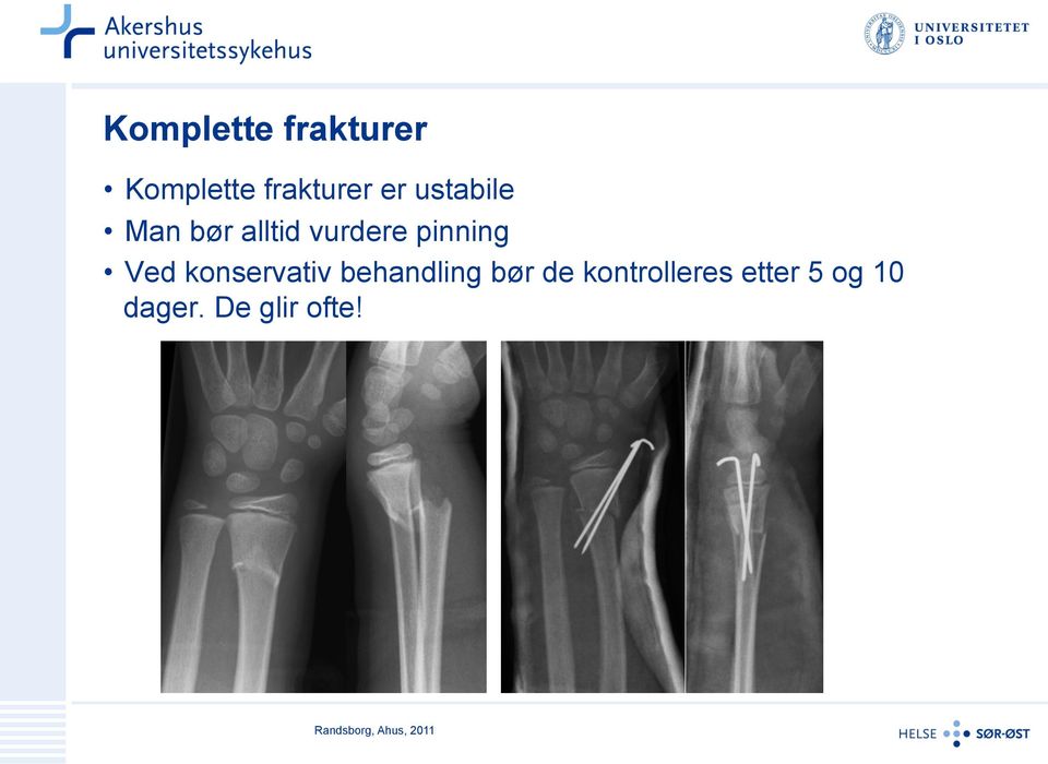 konservativ behandling bør de kontrolleres