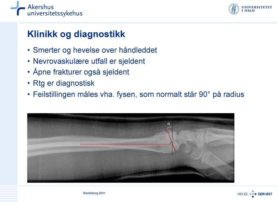 frakturer også sjeldent Rtg er diagnostisk