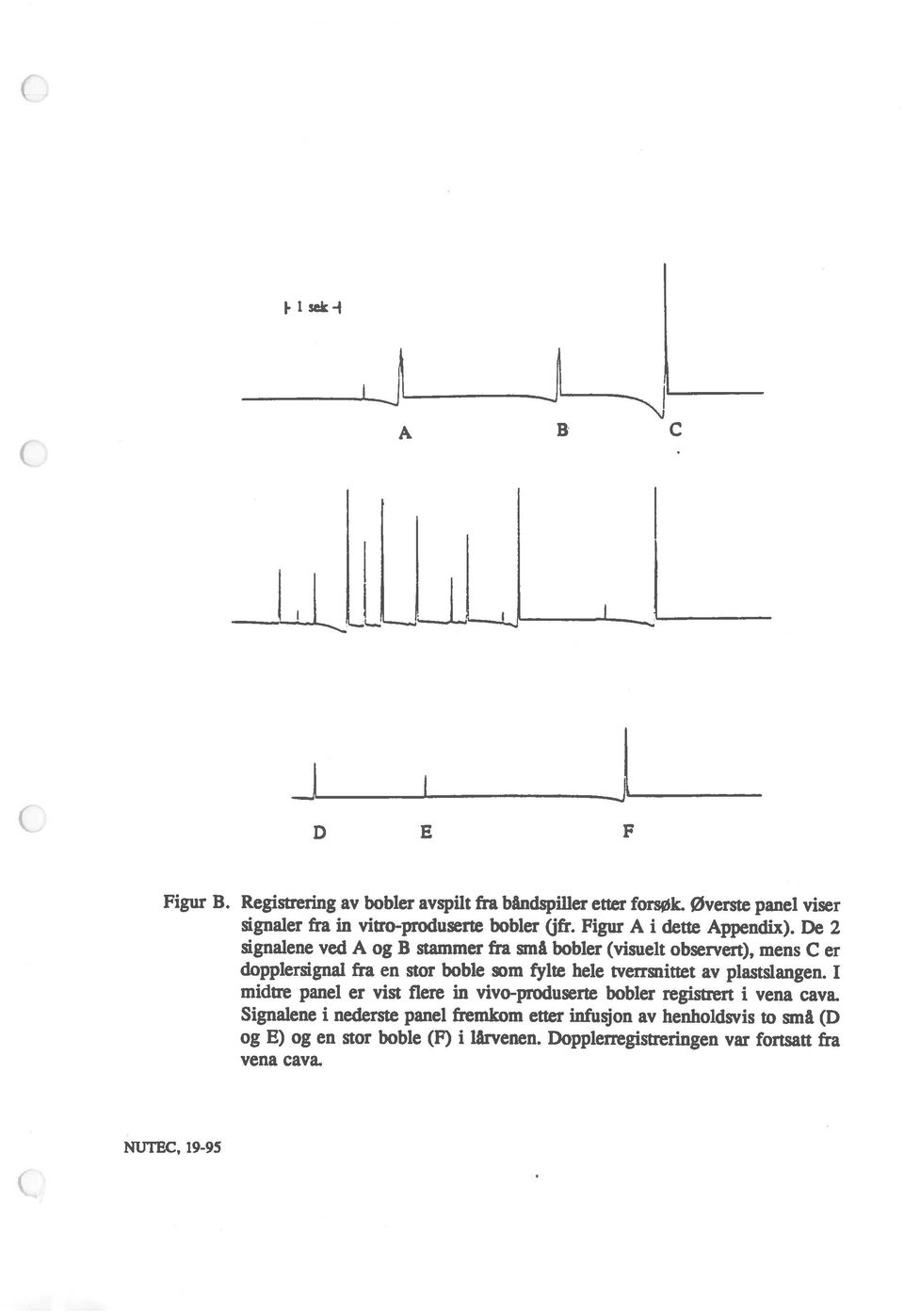 De 2 signalene ved A og B stammer fra små bobler (visuelt observert), mens C er dopplersignal fra en stor boble m fylte hele tverrsnittet av