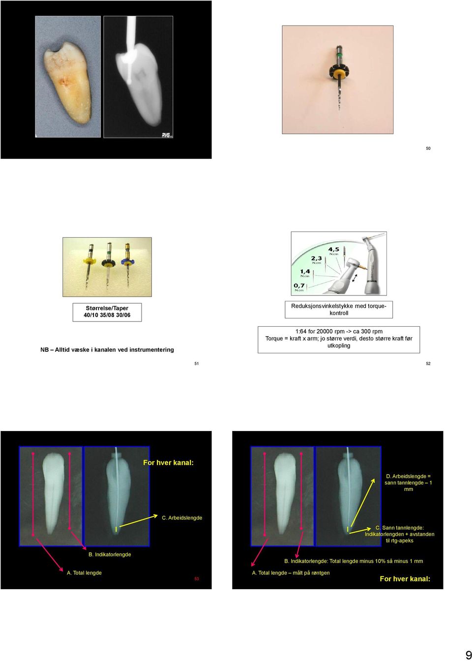 Arbeidslengde = sann tannlengde 1 mm C. Arbeidslengde C. Sann tannlengde: Indikatorlengden + avstanden til rtg-apeks B.