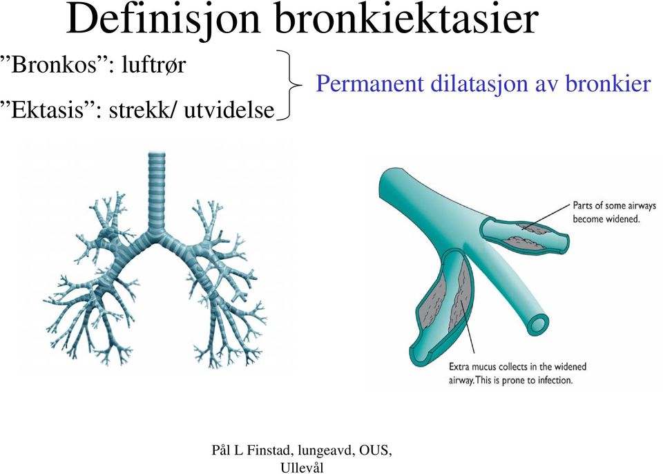 : strekk/ utvidelse