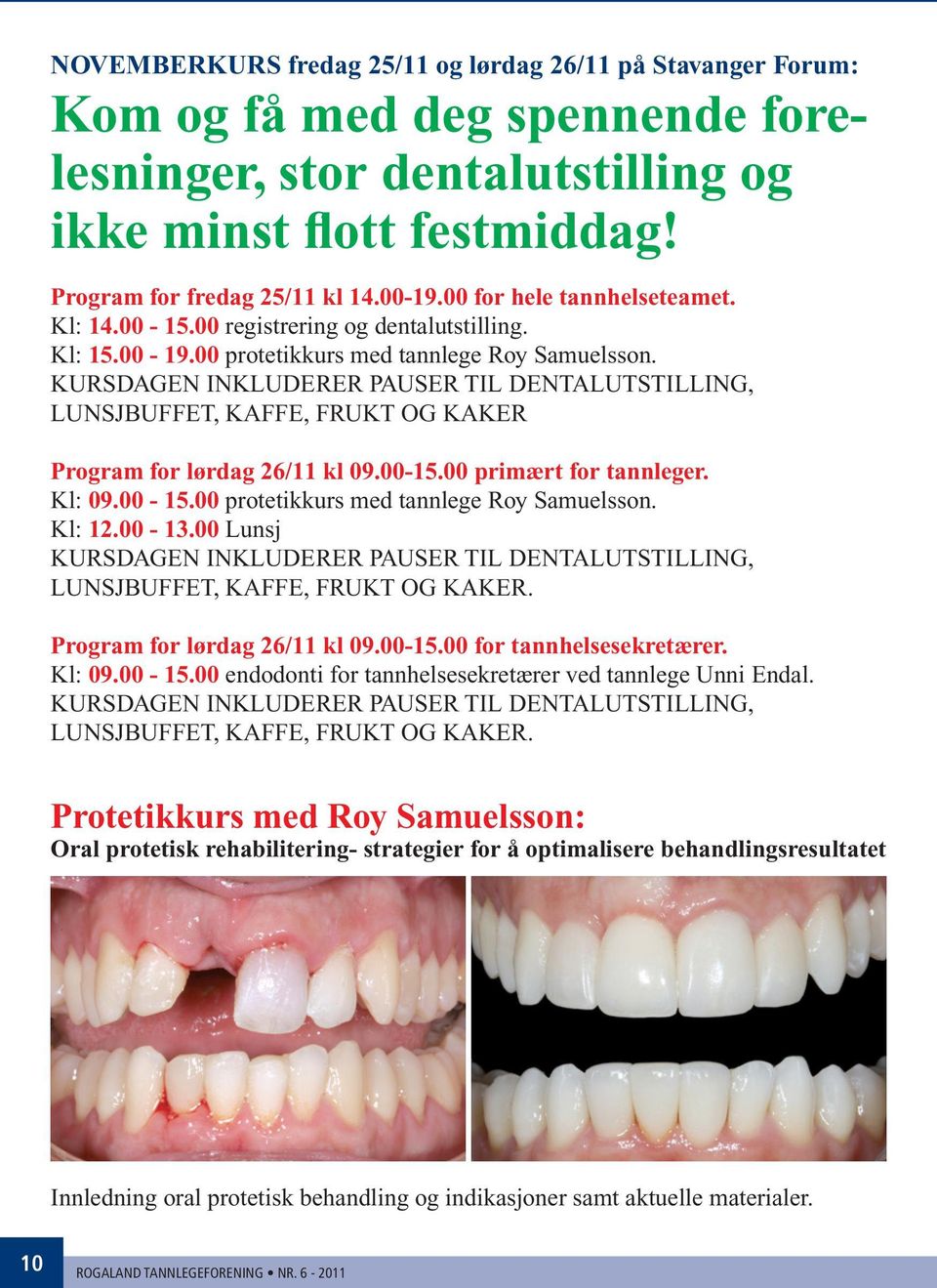 KURSDAGEN INKLUDERER PAUSER TIL DENTALUTSTILLING, LUNSJBUFFET, KAFFE, FRUKT OG KAKER Program for lørdag 26/11 kl 09.00-15.00 primært for tannleger. Kl: 09.00-15.00 protetikkurs med tannlege Roy Samuelsson.