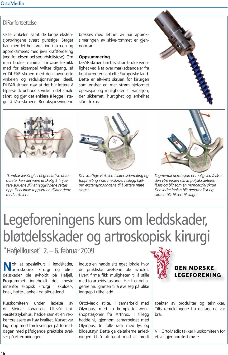 Om man bruker minimal innvasiv teknikk med for eksempel Wiltse tilgang, så er DI FAR skruen med den favoriserte vinkelen og reduksjonsvinger ideell.