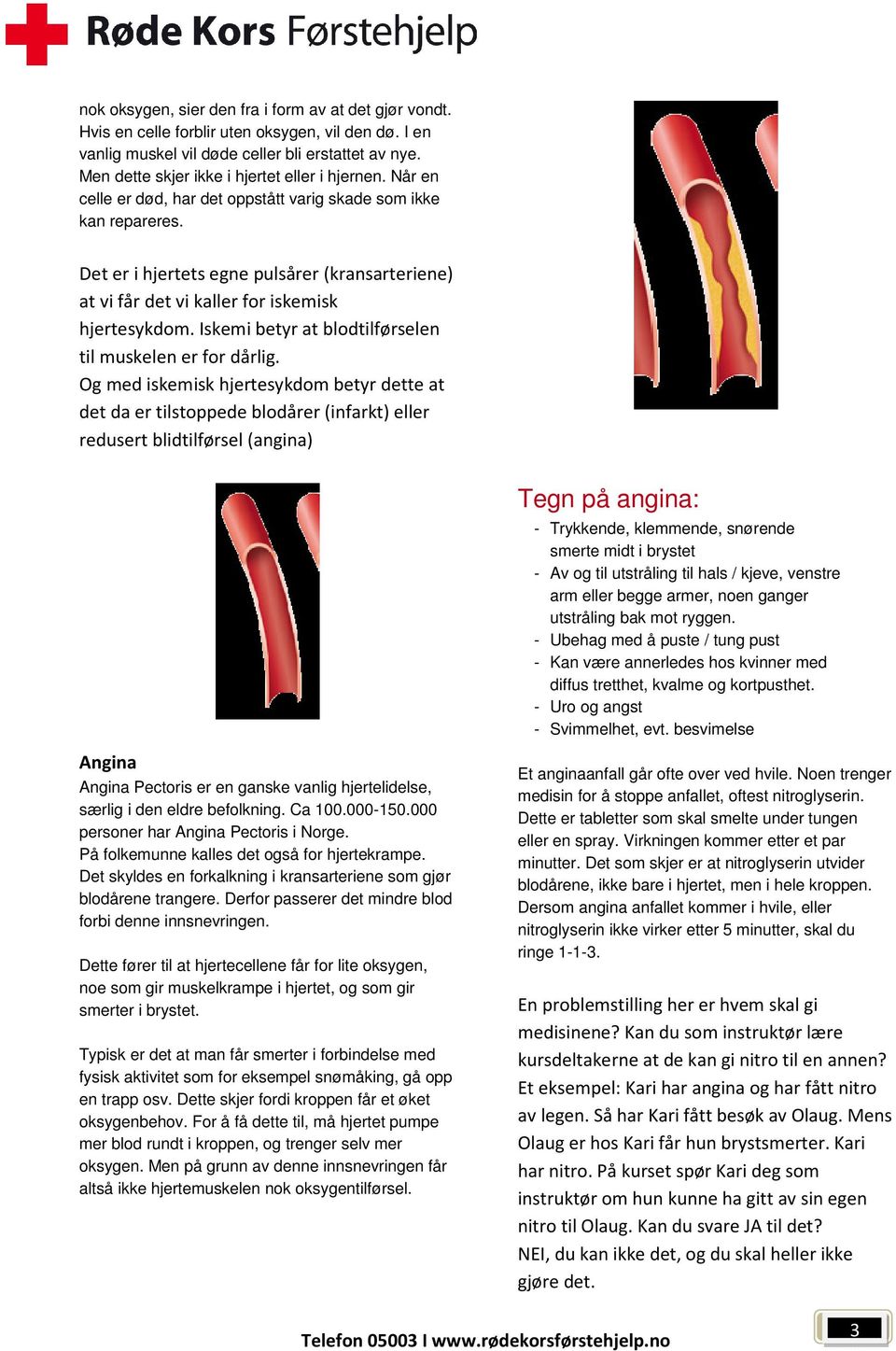 Det er i hjertets egne pulsårer (kransarteriene) at vi får det vi kaller for iskemisk hjertesykdom. Iskemi betyr at blodtilførselen til muskelen er for dårlig.