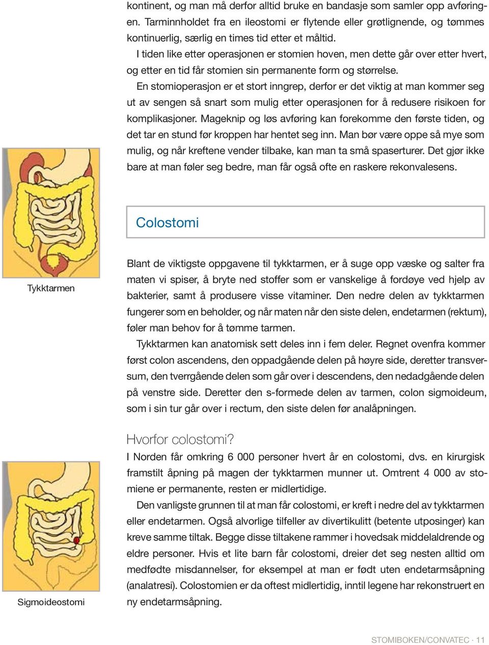 I tiden like etter operasjonen er stomien hoven, men dette går over etter hvert, og etter en tid får stomien sin permanente form og størrelse.