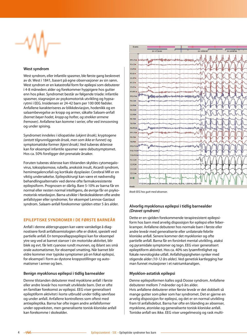 Syndromet består av følgende triade: infantile spasmer, stagnasjon av psykomotorisk utvikling og hypsarytmi i EEG. Insidensen er 24-42 barn per 100 000 fødsler.