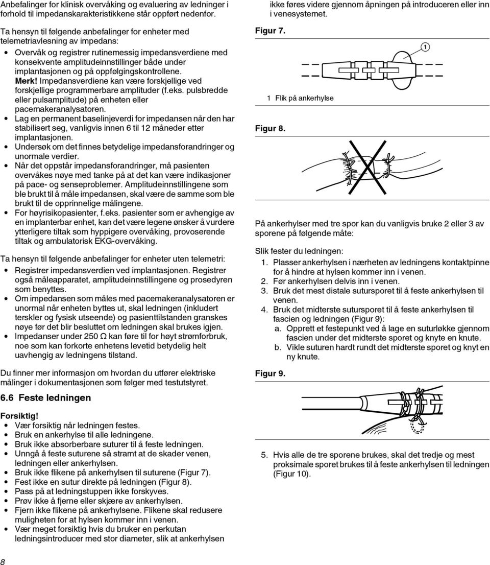 og på oppfølgingskontrollene. Merk! Impedansverdiene kan være forskjellige ved forskjellige programmerbare amplituder (f.eks. pulsbredde eller pulsamplitude) på enheten eller pacemakeranalysatoren.