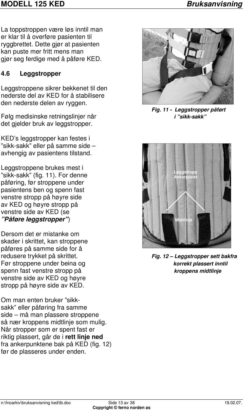 11 - Leggstropper påført i sikk-sakk KED s leggstropper kan festes i sikk-sakk eller på samme side avhengig av pasientens tilstand. Leggstroppene brukes mest i sikk-sakk (fig. 11).