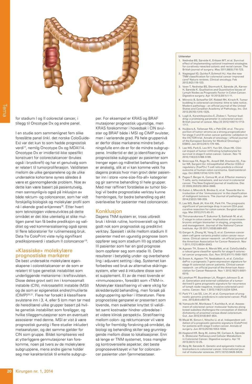 Veen T, Nedrebø BS, Stormark K, Søreide JA, Kørner H, Søreide K. Qualitative and Quantitative Issues of Lymph Nodes as Prognostic Factor in Colon Cancer. Digestive surgery. Apr 10 2013;30(1):1-11. 4.