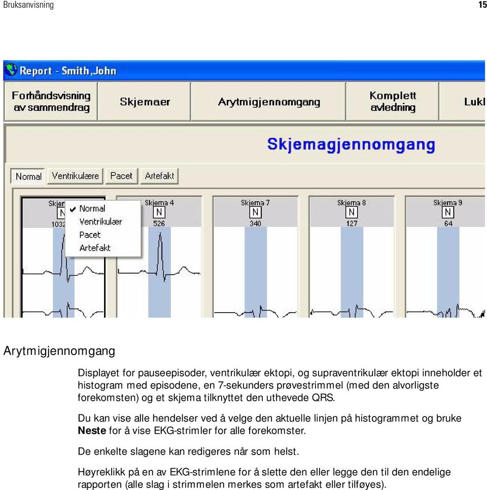 Du kan vise alle hendelser ved å velge den aktuelle linjen på histogrammet og bruke Neste for å vise EKG-strimler for alle forekomster.