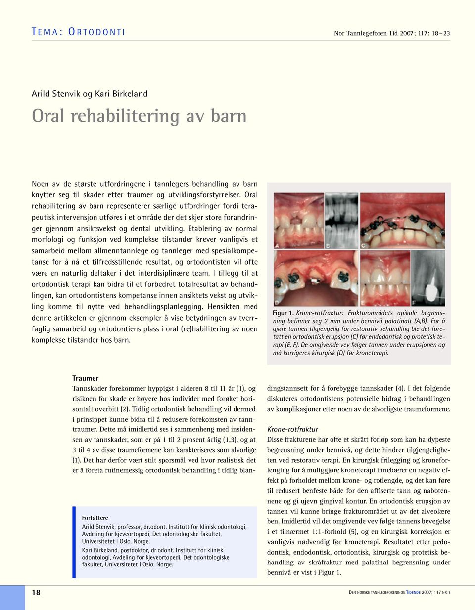 Oral rehabilitering av barn representerer særlige utfordringer fordi terapeutisk intervensjon utføres i et område der det skjer store forandringer gjennom ansiktsvekst og dental utvikling.