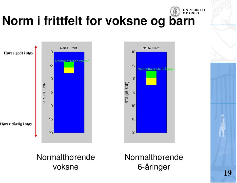 dårlig i støy Normalthørende