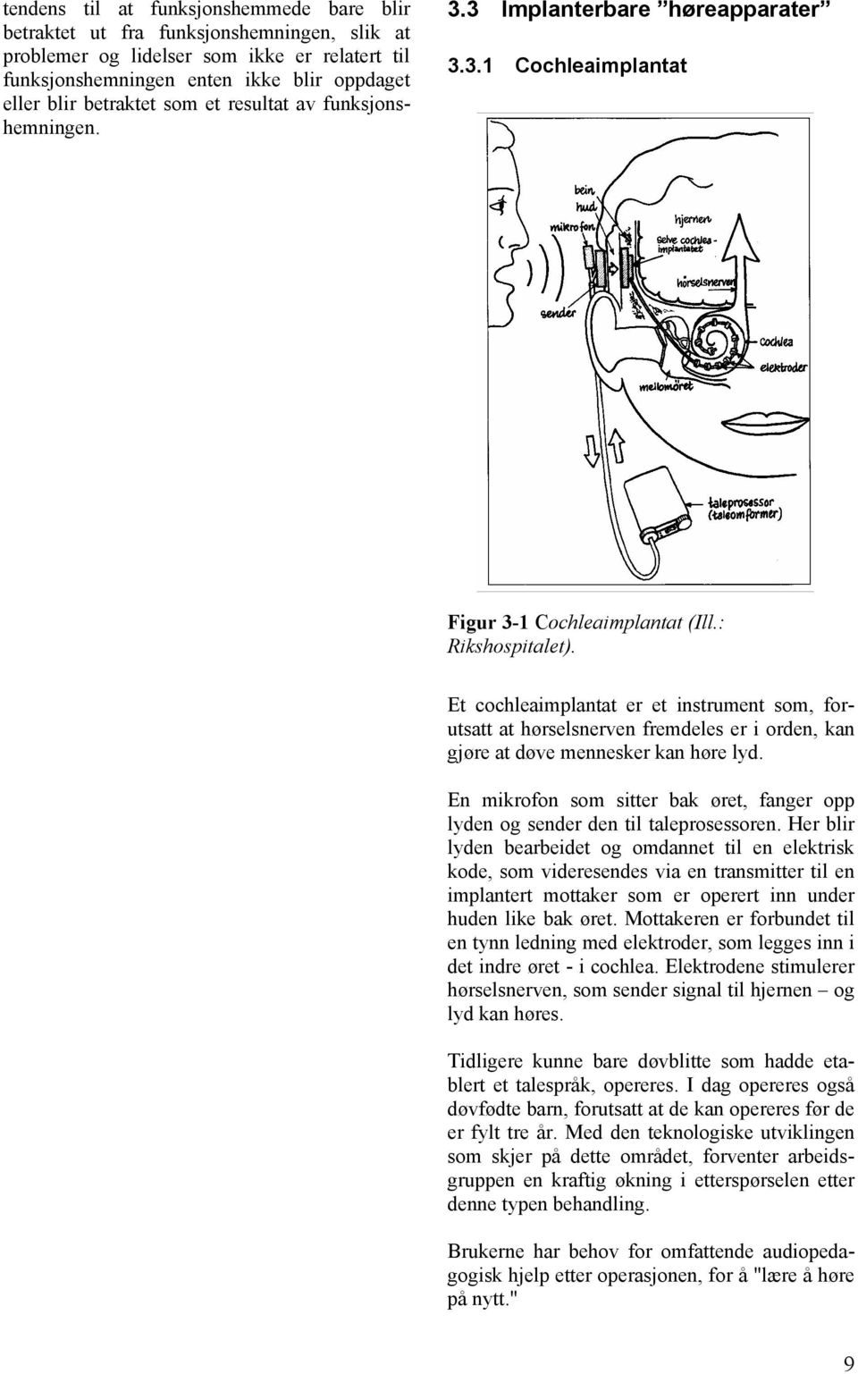 Et cochleaimplantat er et instrument som, forutsatt at hørselsnerven fremdeles er i orden, kan gjøre at døve mennesker kan høre lyd.