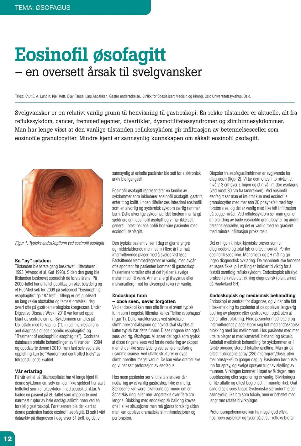 En rekke tilstander er aktuelle, alt fra reflukssykdom, cancer, fremmedlegemer, divertikler, dysmotilitetessyndromer og slimhinnesykdommer.