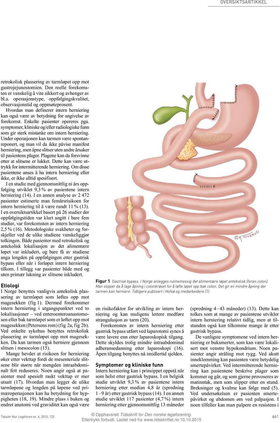 symptomer, kliniske og/eller radiologiske funn som gir sterk mistanke om intern herniering.