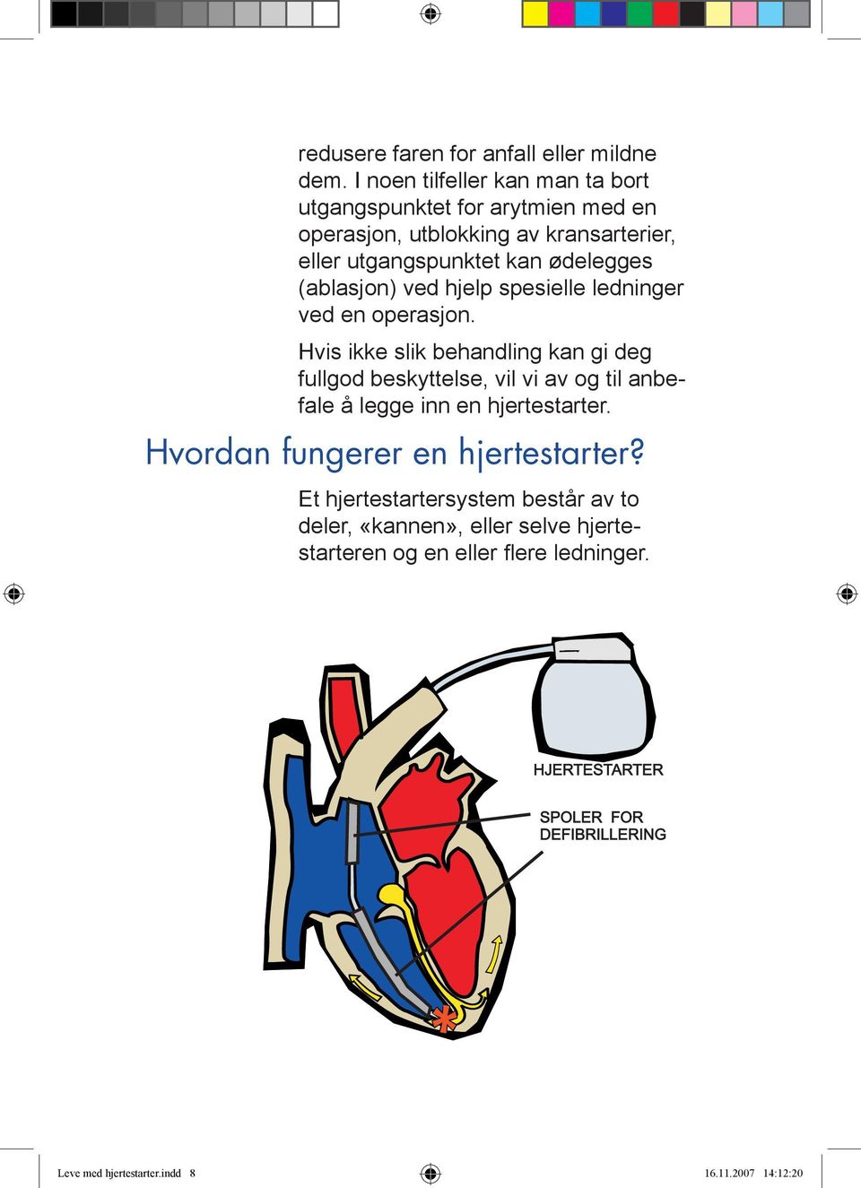 ødelegges (ablasjon) ved hjelp spesielle ledninger ved en operasjon.