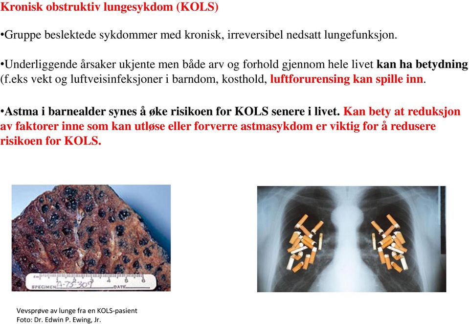 eks vekt og luftveisinfeksjoner i barndom, kosthold, luftforurensing kan spille inn.