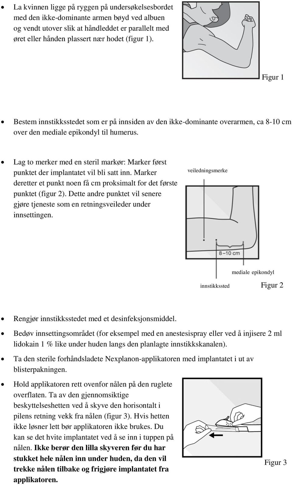 Lag to merker med en steril markør: Marker først punktet der implantatet vil bli satt inn. Marker deretter et punkt noen få cm proksimalt for det første punktet (figur 2).