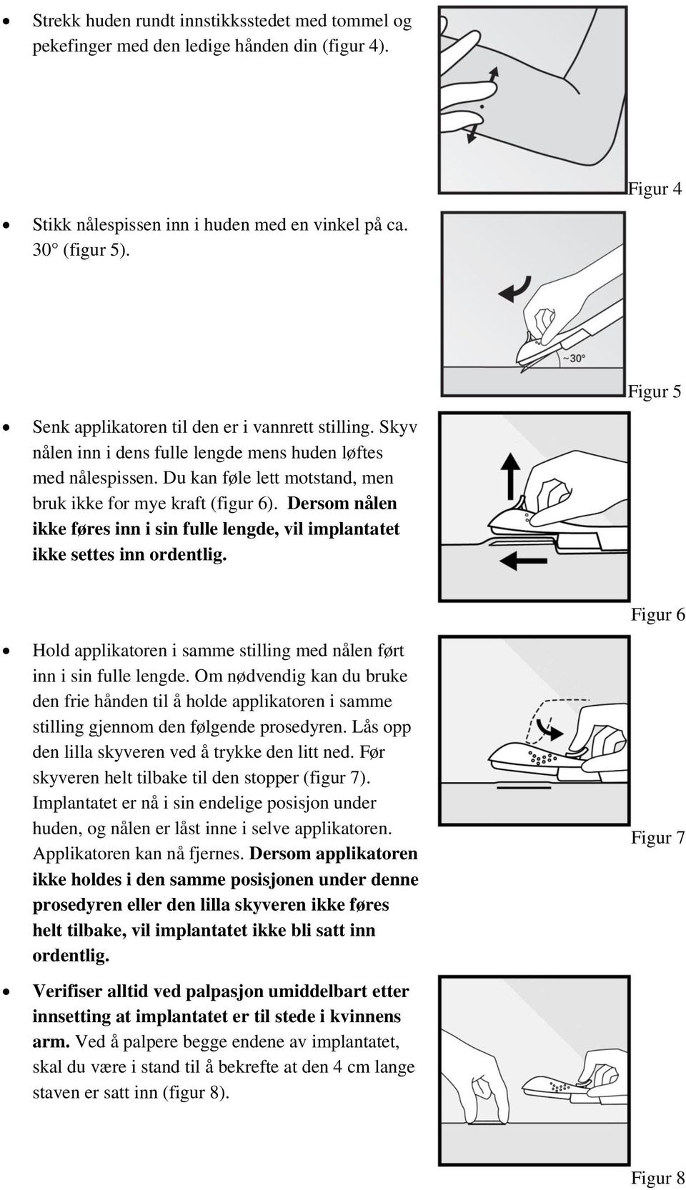 Dersom nålen ikke føres inn i sin fulle lengde, vil implantatet ikke settes inn ordentlig. Hold applikatoren i samme stilling med nålen ført inn i sin fulle lengde.