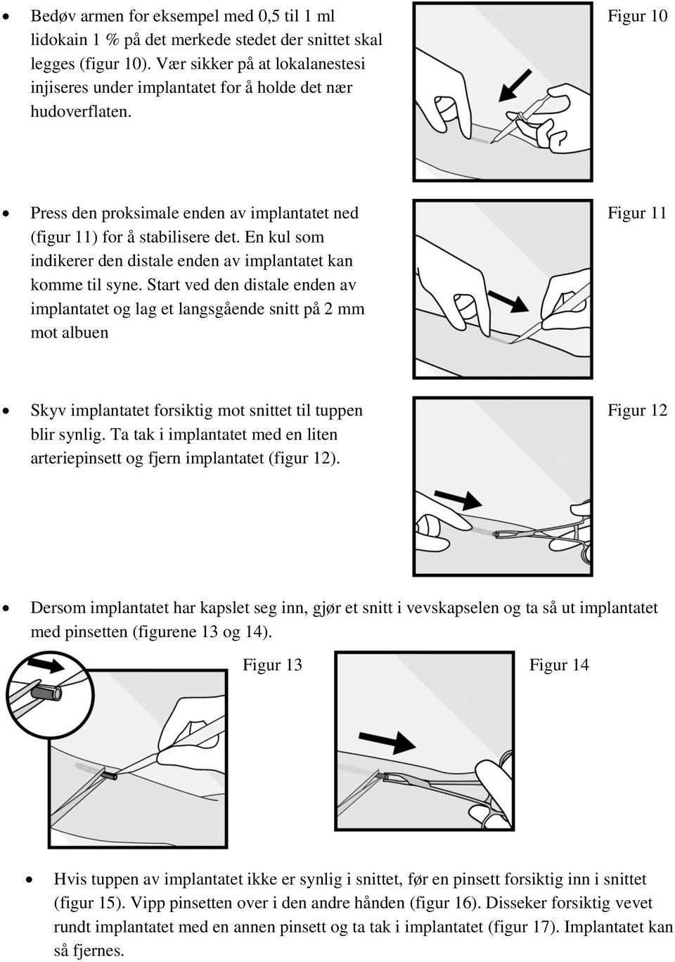 En kul som indikerer den distale enden av implantatet kan komme til syne.