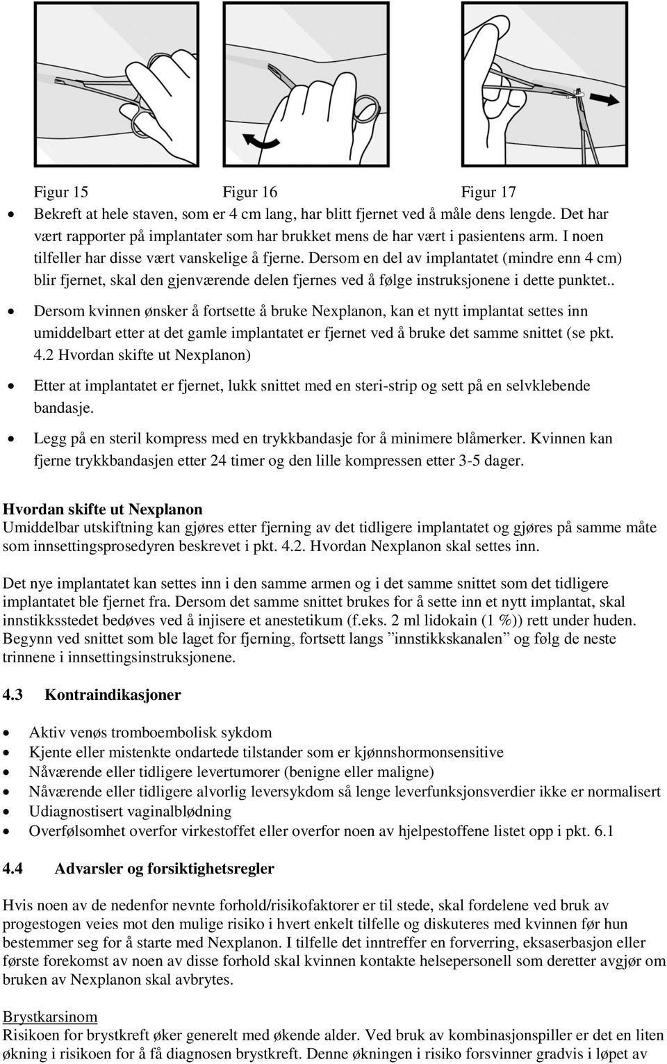 . Dersom kvinnen ønsker å fortsette å bruke Nexplanon, kan et nytt implantat settes inn umiddelbart etter at det gamle implantatet er fjernet ved å bruke det samme snittet (se pkt. 4.