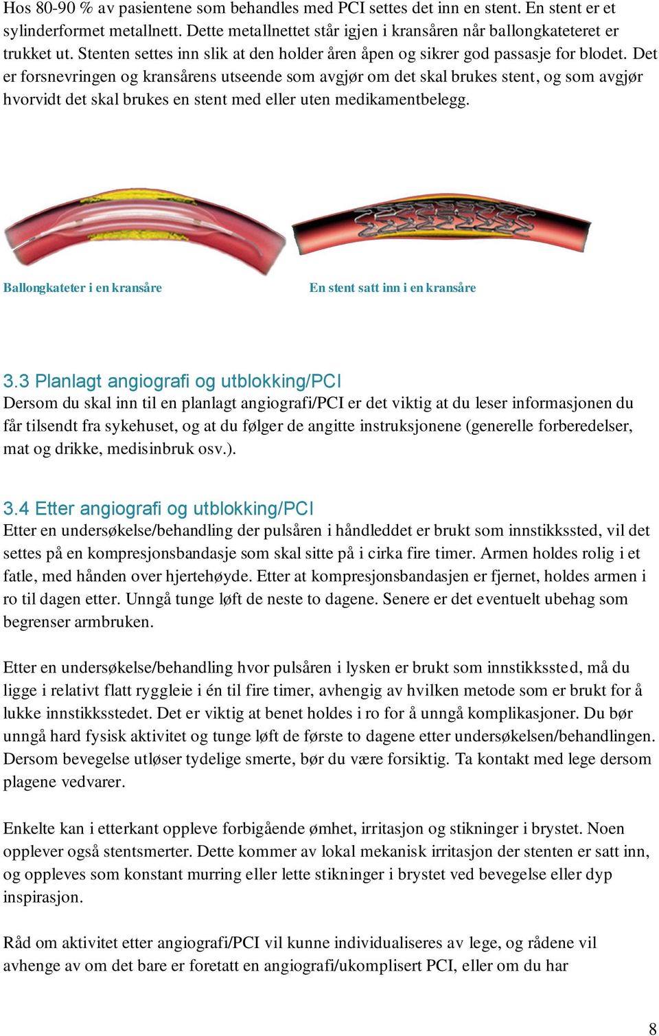 Det er forsnevringen og kransårens utseende som avgjør om det skal brukes stent, og som avgjør hvorvidt det skal brukes en stent med eller uten medikamentbelegg.