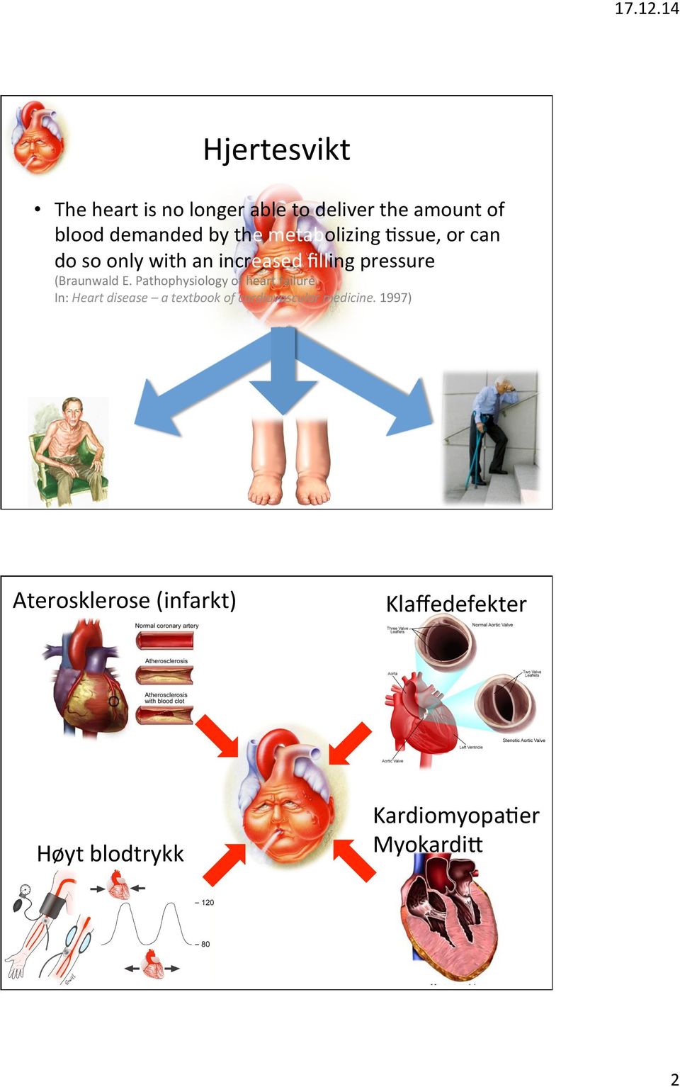 metabolizing Dssue, or can do so only with an increased ﬁlling pressure (Braunwald E.