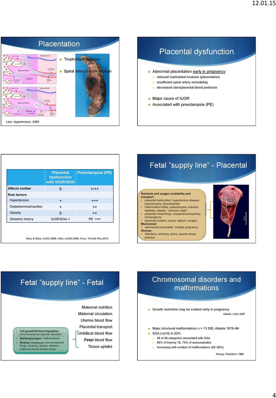 Associated with preeclampsia (PE) Lam, Hypertension, 2005 Placental dysfunction with IUGR/SGA Preeclampsia (PE) Affects mother 0 +/++ Risk factors Hypertension + +++ Diabetes/renal/cardiac + ++