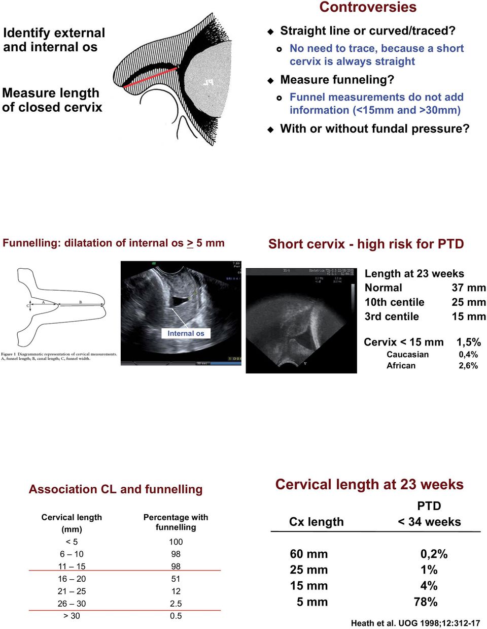 Funnelling: dilatation of internal os > 5 mm Short cervix - high risk for PTD Length at 23 weeks Normal 37 mm 10th centile 25 mm 3rd centile 15 mm Internal os Cervix < 15 mm 1,5% Caucasian